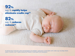 Cradle cap cream