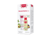 Stretch marks set
